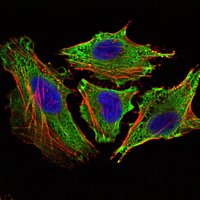 Immunofluorescence analysis of Hela cells using STAT6 mouse mAb (green). Blue