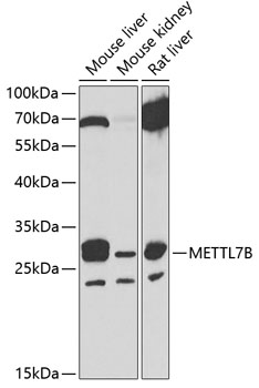 Western blot - METTL7B Polyclonal Antibody 