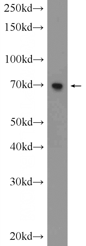 C6 cells were subjected to SDS PAGE followed by western blot with Catalog No:117075(AUTS2 Antibody) at dilution of 1:600
