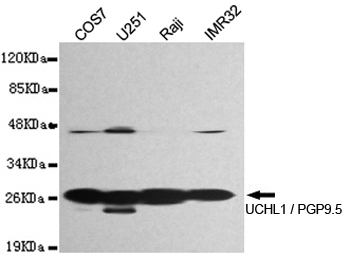 Western blot detection of UCHL1 / PGP9.5 in U251,IMR32,Raji and COS7 cell lysates and using UCHL1 / PGP9.5 mouse mAb (1:1000 diluted).Predicted band size: 25KDa.Observed band size: 28KDa.