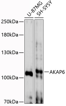 Western blot - AKAP6 Polyclonal Antibody 