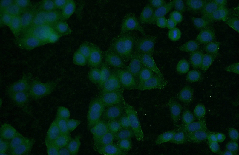 Immunofluorescent analysis of HeLa cells using Catalog No:114783(ROM1 Antibody) at dilution of 1:50 and Alexa Fluor 488-congugated AffiniPure Goat Anti-Rabbit IgG(H+L)