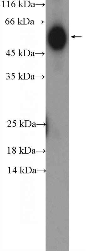 human plasma (0.3ug) tissue were subjected to SDS PAGE followed by western blot with Catalog No:111722(human IgG heavy chain Antibody) at dilution of 1:1000