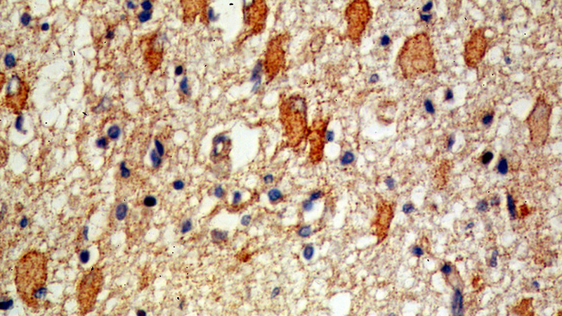 Immunohistochemical of paraffin-embedded human brain using Catalog No:113371(NUMB antibody) at dilution of 1:100 (under 40x lens)