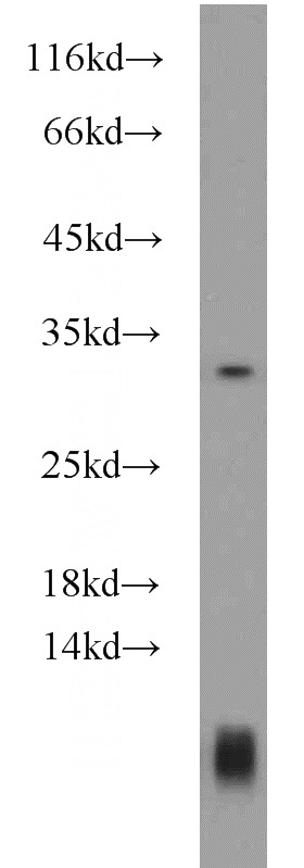 mouse spleen tissue were subjected to SDS PAGE followed by western blot with Catalog No:108212(ASB17 antibody) at dilution of 1:600