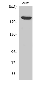 Fig1:; Western Blot analysis of various cells using ZC3H13 Polyclonal Antibody. Secondary antibody（catalog#: HA1001) was diluted at 1:20000
