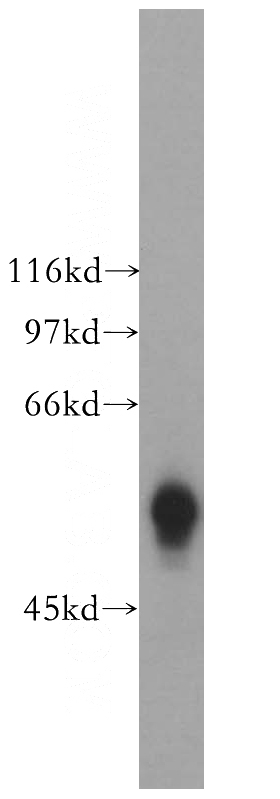 Jurkat cells were subjected to SDS PAGE followed by western blot with Catalog No:111016(GK5 antibody) at dilution of 1:500