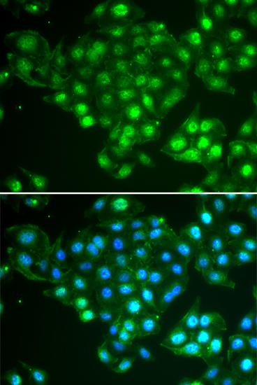 Immunofluorescence - ABCA3 Polyclonal Antibody 