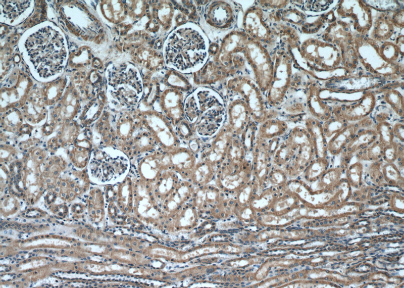 Immunohistochemical of paraffin-embedded human kidney using Catalog No:111847(INSC antibody) at dilution of 1:50 (under 10x lens)