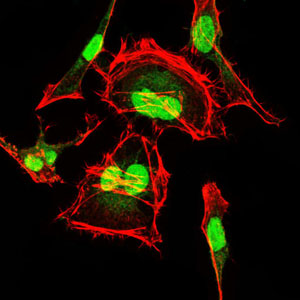 Immunofluorescence analysis of HeLa cells using CDK2 mouse mAb (green). Red: Actin filaments have been labeled with Alexa Fluor-555 phalloidin.