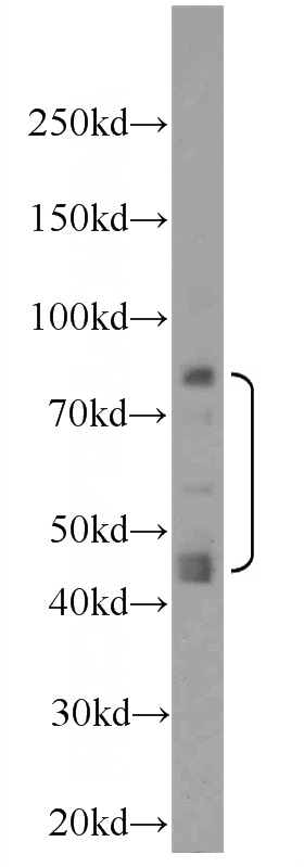 HeLa cells were subjected to SDS PAGE followed by western blot with Catalog No:112732(RAGE Antibody) at dilution of 1:1000