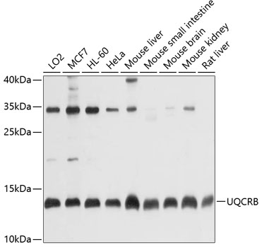Western blot - UQCRB Polyclonal Antibody 
