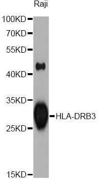 Western blot - HLA-DRB3 Polyclonal Antibody 