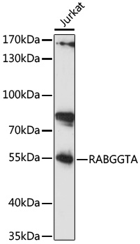 Western blot - RABGGTA Polyclonal Antibody 