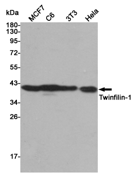 Western blot detection of Twinfilin-1 in MCF7,C6,3T3 and Hela cell lysates using Twinfilin-1 mouse mAb (1:5000 diluted).Predicted band size:40KDa.Observed band size:40KDa.