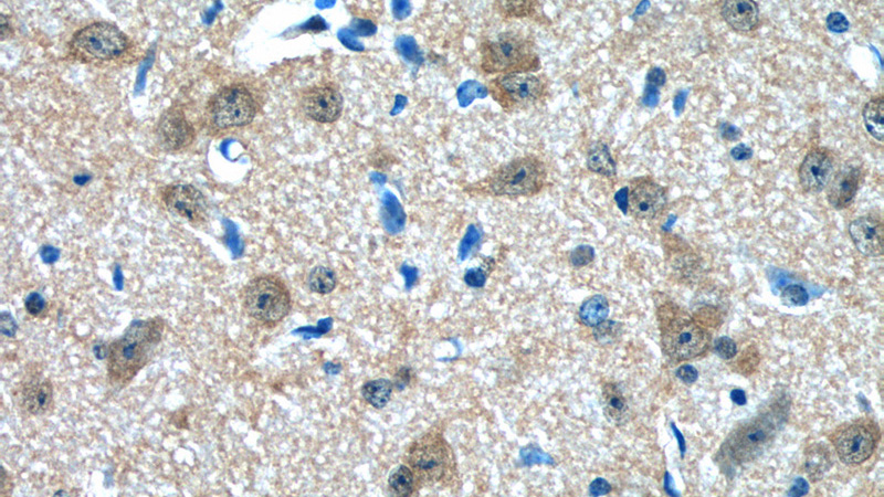 Immunohistochemistry of paraffin-embedded mouse brain tissue slide using Catalog No:109223(CHERP Antibody) at dilution of 1:50 (under 40x lens)