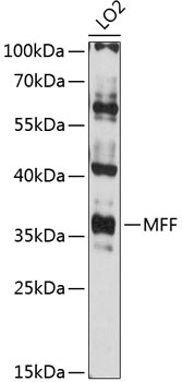 Western blot - MFF Polyclonal Antibody 