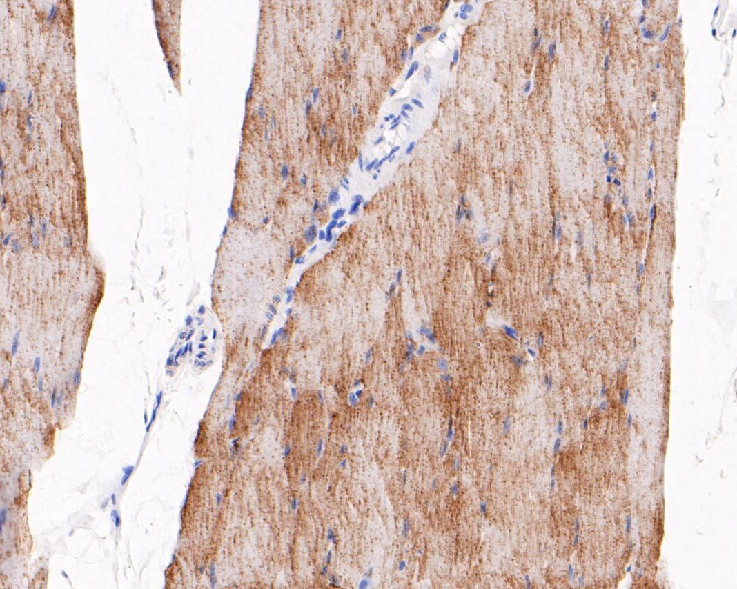 Fig2: Immunohistochemical analysis of paraffin-embedded rat skeletal muscle tissue using anti-TRIM72 antibody. The section was pre-treated using heat mediated antigen retrieval with Tris-EDTA buffer (pH 8.0-8.4) for 20 minutes.The tissues were blocked in 5% BSA for 30 minutes at room temperature, washed with ddH2O and PBS, and then probed with the primary antibody ( 1/200) for 30 minutes at room temperature. The detection was performed using an HRP conjugated compact polymer system. DAB was used as the chromogen. Tissues were counterstained with hematoxylin and mounted with DPX.