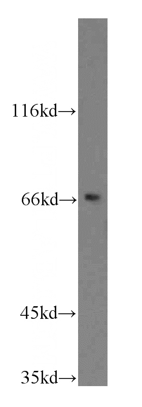 K-562 cells were subjected to SDS PAGE followed by western blot with Catalog No:109063(CD1A antibody) at dilution of 1:800