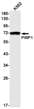 Western blot detection of PWP1 in K562 cell lysates using PWP1 Rabbit mAb(1:1000 diluted).Predicted band size:56kDa.Observed band size:75kDa.