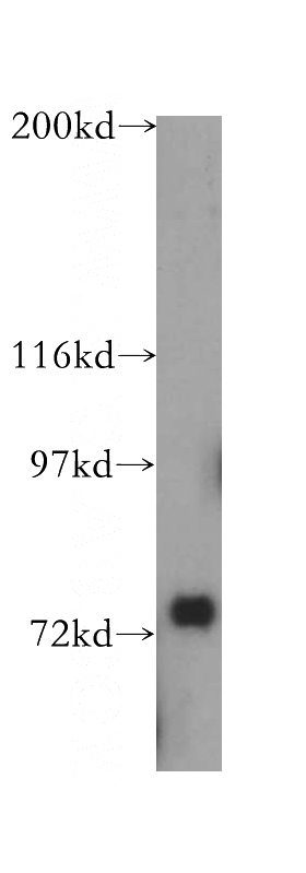 human heart tissue were subjected to SDS PAGE followed by western blot with Catalog No:116691(USP53 antibody) at dilution of 1:300