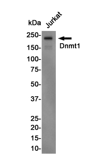 Western blot detection of DNMT1 in Jurkat cell lysates using DNMT1 Rabbit pAb(1:1000 diluted).Predicted band size:183KDa.Observed band size:183KDa.