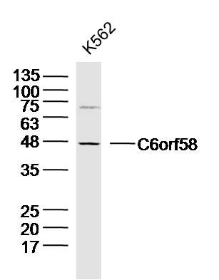 Fig1: Sample:; K562 Cell (Human) Lysate at 30 ug; Primary: Anti- C6orf58 at 1/300 dilution; Secondary: IRDye800CW Goat Anti-Rabbit IgG at 1/20000 dilution; Predicted band size: 36kD; Observed band size: 46kD