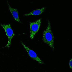 Confocal immunofluorescence analysis of methanol-fixed Eca-109 cells using Cytokeratin (Pan) mouse mAb (green), showing cytoplasmic localization. Blue