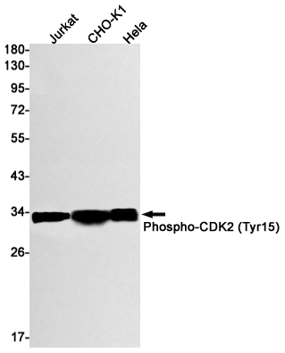 Western blot detection of Phospho-CDK2 (Tyr15) in Jurkat,CHO-K1,Hela cell lysates using Phospho-CDK2 (Tyr15) Rabbit mAb(1:1000 diluted).Predicted band size:34kDa.Observed band size:34kDa.