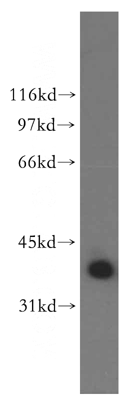 K-562 cells were subjected to SDS PAGE followed by western blot with Catalog No:114367(QKI antibody) at dilution of 1:400