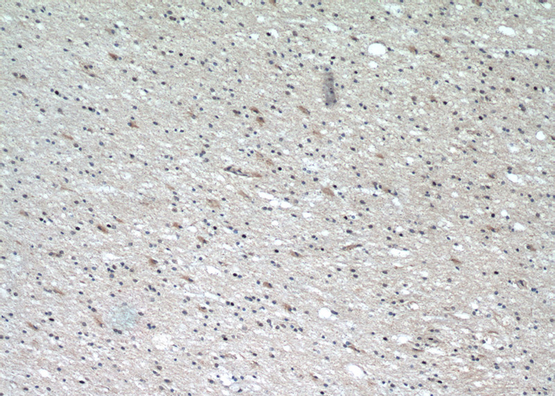 Immunohistochemical of paraffin-embedded human brain using Catalog No:111583(IBA1 antibody) at dilution of 1:50 (under 10x lens)