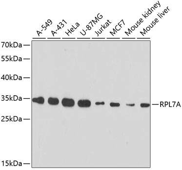 Western blot - RPL7A Polyclonal Antibody 