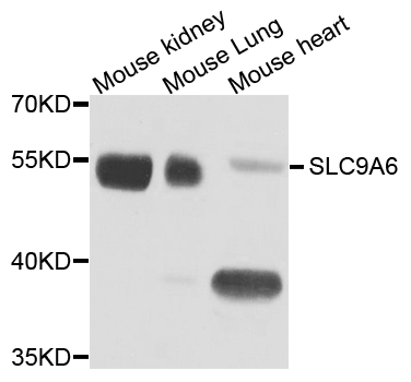 Western blot - SLC9A6 Polyclonal Antibody 