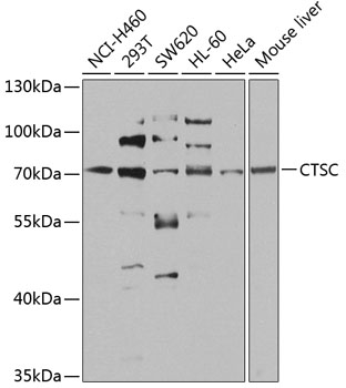 Western blot - CTSC Polyclonal Antibody 