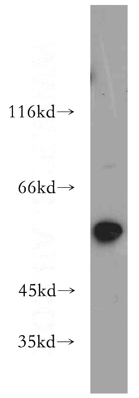 mouse heart tissue were subjected to SDS PAGE followed by western blot with Catalog No:115305(SLC16A2 antibody) at dilution of 1:600