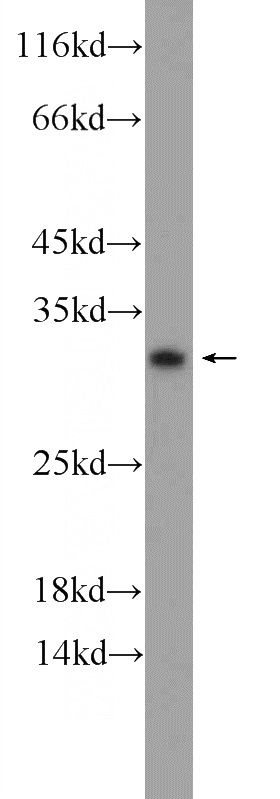 A431 cells were subjected to SDS PAGE followed by western blot with Catalog No:108670(C15orf53 Antibody) at dilution of 1:1000