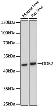 Western blot - DDB2 Polyclonal Antibody 