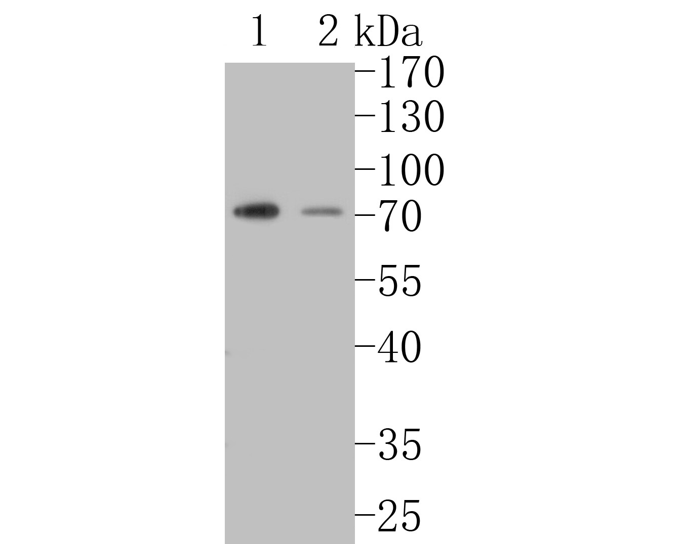Fig1:; Western blot analysis of SLFN12 on different lysates. Proteins were transferred to a PVDF membrane and blocked with 5% BSA in PBS for 1 hour at room temperature. The primary antibody ( 1/500) was used in 5% BSA at room temperature for 2 hours. Goat Anti-Rabbit IgG - HRP Secondary Antibody (HA1001) at 1:5,000 dilution was used for 1 hour at room temperature.; Positive control:; Lane 1: U937 cell lysate; Lane 2: HL-60 cell lysate
