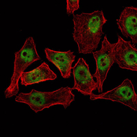 Fig2: ICC staining THAP11 (green) and actin filaments (red) in NTERA-2 cells. Cells were fixed in paraformaldehyde, permeabilised with 0.25% Triton X100/PBS.