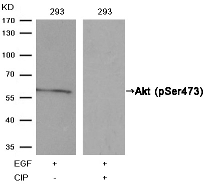 Western blot analysis of extracts from 293 cells, treated with EGF or calf intestinal phosphatase (CIP), using Akt (Phospho-Ser473) Antibody .