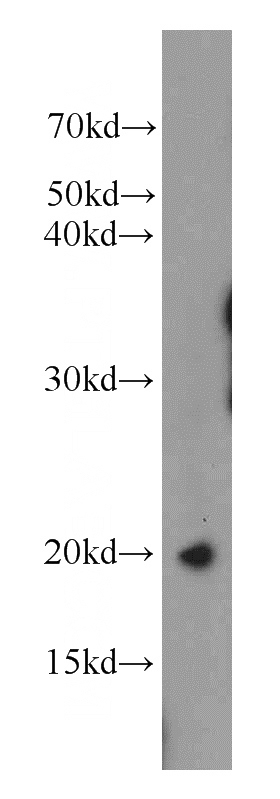 PC-3 cells were subjected to SDS PAGE followed by western blot with Catalog No:116214(TPPP3 antibody) at dilution of 1:100