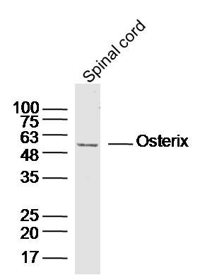 Fig3: Sample:Spinal cord (Mouse) Lysate at 40 ug; Primary: Anti-Osterix at 1/300 dilution; Secondary: IRDye800CW Goat Anti-Rabbit IgG at 1/20000 dilution; Predicted band size: 45kD; Observed band size: 50kD