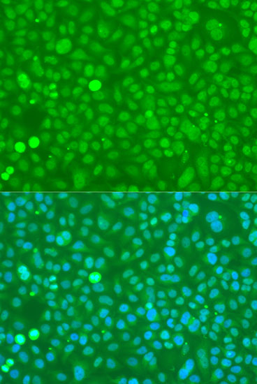 Immunofluorescence - UBC Polyclonal Antibody 