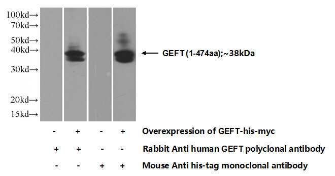 Transfected HEK-293 cells were subjected to SDS PAGE followed by western blot with Catalog No:110934(GEFT Antibody) at dilution of 1:1000