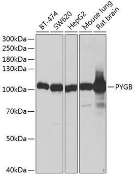 Western blot - PYGB Polyclonal Antibody 