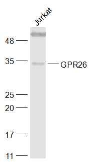 Fig1: Sample:; Jurkat(Human) Cell Lysate at 30 ug; Primary: Anti-GPR26 at 1/1000 dilution; Secondary: IRDye800CW Goat Anti-Rabbit IgG at 1/20000 dilution; Predicted band size: 38 kD; Observed band size: 34 kD
