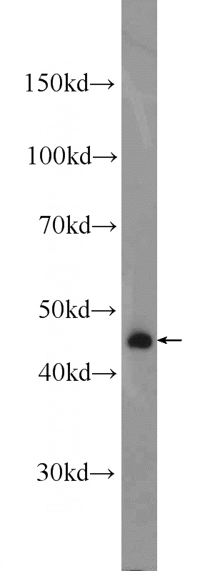 mouse heart tissue were subjected to SDS PAGE followed by western blot with Catalog No:108396(B4GALT6 Antibody) at dilution of 1:600