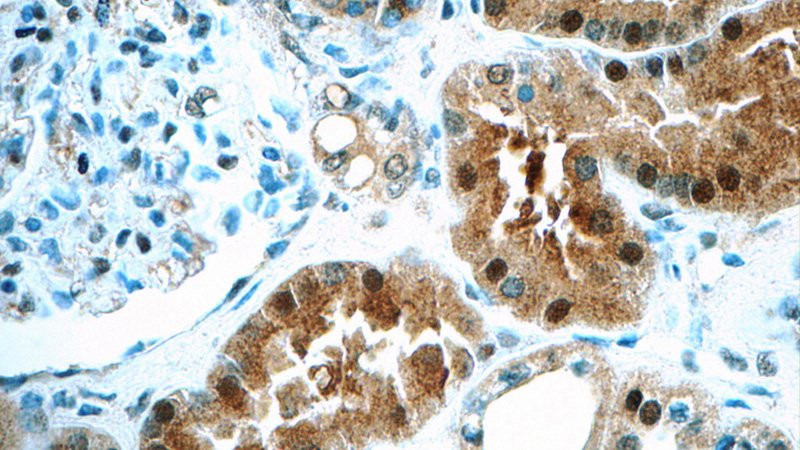 Immunohistochemistry of paraffin-embedded human kidney tissue slide using Catalog No:116383(TTC37 Antibody) at dilution of 1:50 (under 40x lens)