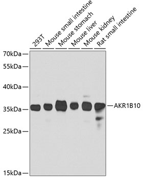 Western blot - AKR1B10 Polyclonal Antibody 