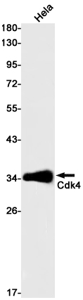 Western blot detection of Cdk4 in Hela cell lysates using Cdk4 Rabbit pAb(1:1000 diluted).Predicted band size:34kDa.Observed band size:34kDa.